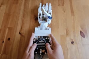 3D printed prosthesis